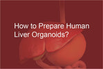 How to prepare human liver organoids