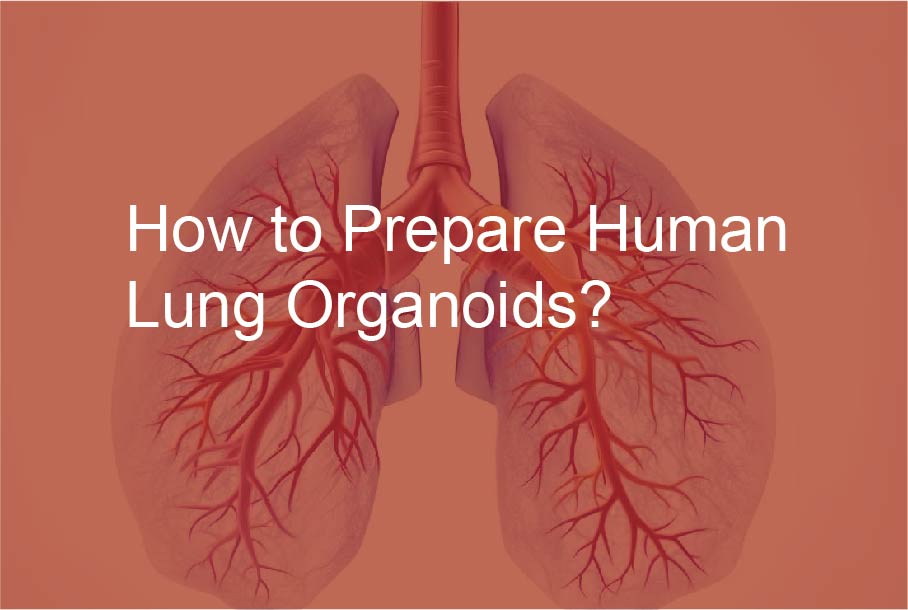 How to Prepare Human Lung Organoids